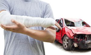 Contact the Holliday Karatinos Law Firm, PLLC today about your broken bones case for a free consultation.